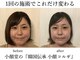 小顔矯正コルギ専門店 小顔堂 心斎橋店の写真