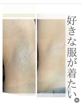 バーグトータルビューティー(bague total beauty)/毛穴もとじてスベスベなお肌に