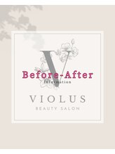 ビオラス(VIOLUS)/☆Before-After☆