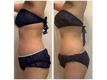 アプローズ(APPLAUSE)