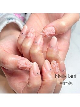ネイルズ ラニ ル トロワ店(Nails Lani)の写真/アクリルスカルプで長さ出し☆折れてしまった爪でも綺麗な指先に戻します[札幌ネイル/スカルプ/大通ネイル]