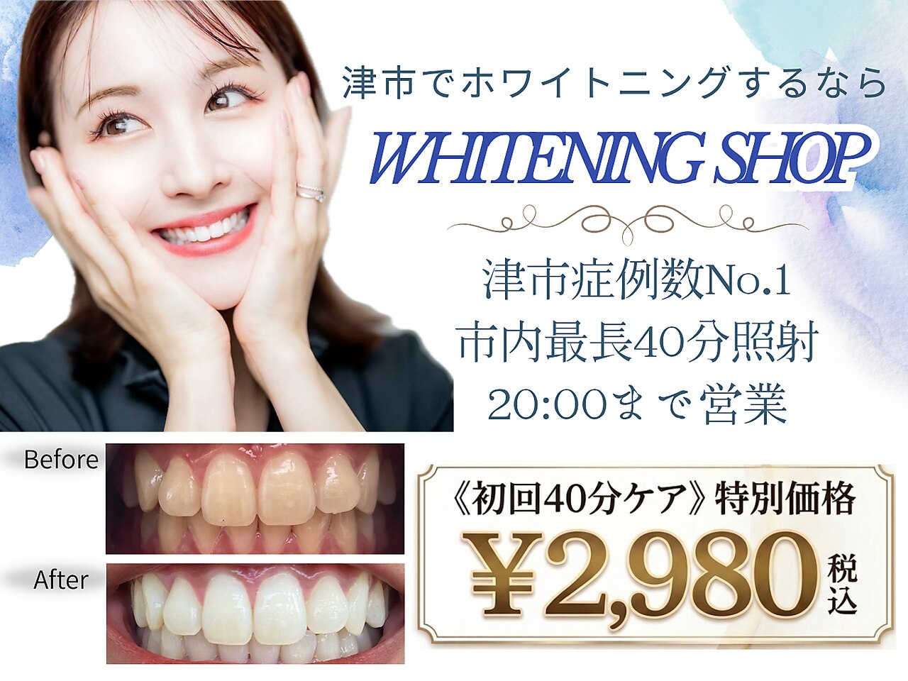 ホワイトニングショップ 津店｜ホットペッパービューティー