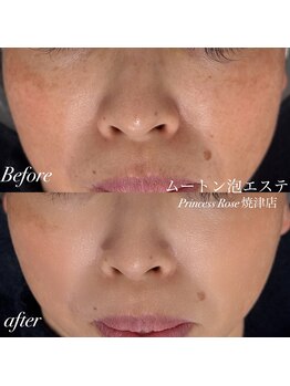 プリンセスローズ 焼津店(Princess Rose)/ムートン泡エステ