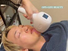 オプス ライフビューティー(OPS×LIFE BEAUTY)/メンズ脱毛１ヶ所￥９９０