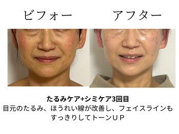 美カナエル(美kanaeru)/シミケア＆トーンUP+たるみケア