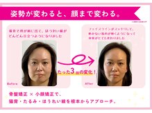 理想の小顔 京橋店