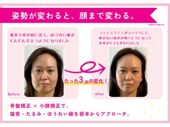 理想の小顔 京橋店