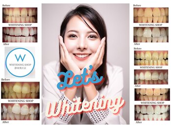 ホワイトニングショップ 葵区静岡駅店/ホワイトニング店ホワイトニング