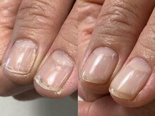 ととりえ/ビフォーアフター