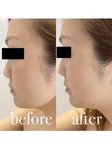 ルルアス(LUluas)/