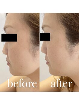 ルルアス(LUluas)/