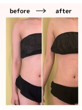 ハニーミー(Honey me)/見た目激変する芸術痩身施術♪