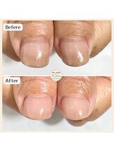 カロッス(Kallos)/ジェル育成　再来