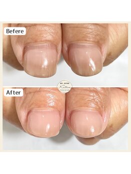 ジェル育成 再来