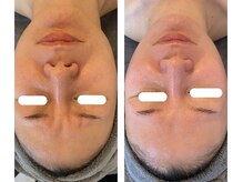 ラ リノ 星ヶ丘(La Lino)/美白＆ハリアプローチ