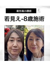 ルシエル/若見え-8歳顔