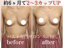 サチ(Sachi)