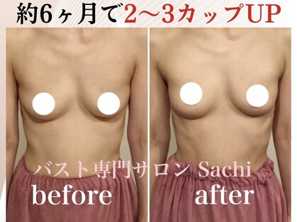 サチ(Sachi)の写真