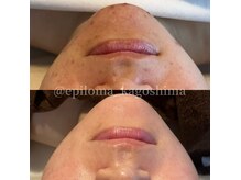 エピロマ(EPILOMA)の雰囲気（目指すは自分史上一番綺麗な艶肌♪リアボーテ直営取扱）