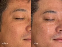 アウラ 小杉店(AULA)/ララピール☆