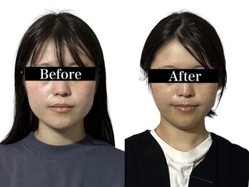 オアシス トウキョウ 心斎橋(OASIS TOKYO)/