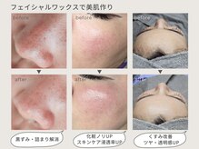 クリード(CLEAD)の雰囲気（フェイシャルワックスでお顔脱毛☆毛穴レスなツヤ肌へ 東京/赤坂）