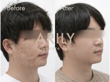 アリリィ(ARILY)/ARILY after care salon