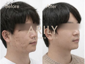 アリリィ(ARILY)/ARILY after care salon