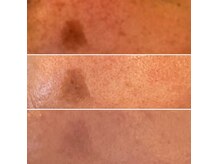 プロヴァンスの雰囲気(30代から悩みレベル10⇒2(無限オーダーメイドF))