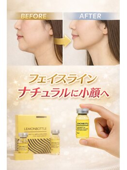 サロン ド ベル(Salon de Belle)/切らずに小顔！