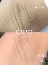 クレーヴ(CREVE)/韓国最先端技術