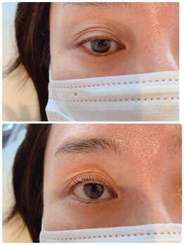 バードアイ(bird eye)/ラッシュリフト