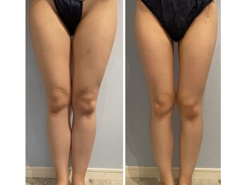 ルナグランデ(Luna grande.)/効果写真