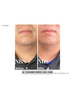 ルクール 柏崎店(Le Coeur)/
