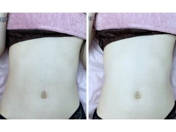 ノゾミジュク(希美熟 NOZOMIJUKU)/くびれお腹