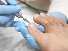 巻き爪専門ラボ 豊田店/施術風景（巻き爪ケア）