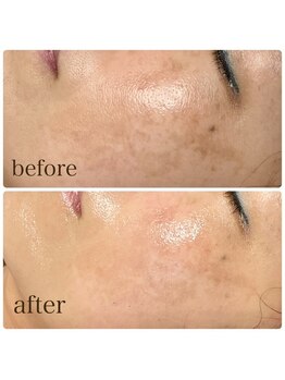 ルアナライフ(Luana Life)/VOSサロンケア白 50代