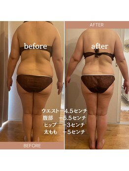 エイミー 藤ヶ丘店(Amy)/before→after