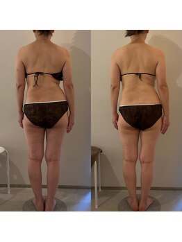 ラナ 京都西院店(Lana)/黄土漢方よもぎ蒸し＆マッサージ