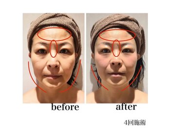 メイ フェアリー 銀座エクステ ネイルサロン(May Fairy)/VAR ビフォーアフター