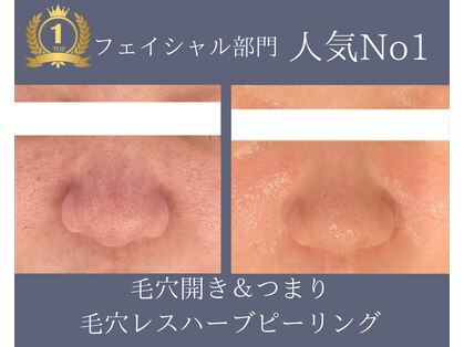 エノアビューティー(ENOA beauty)の写真