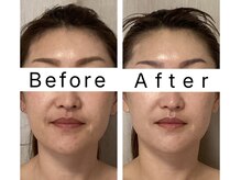 アンシャンテ(Enchant)/40代から始めるスッキリ小顔習慣