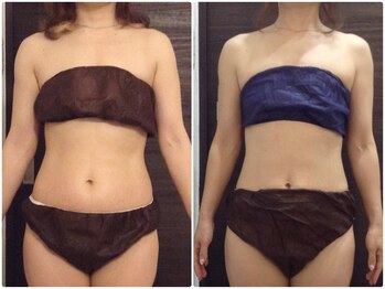 美容整体ウェリナ 名駅院/小顔矯正/骨盤矯正/美脚サロン