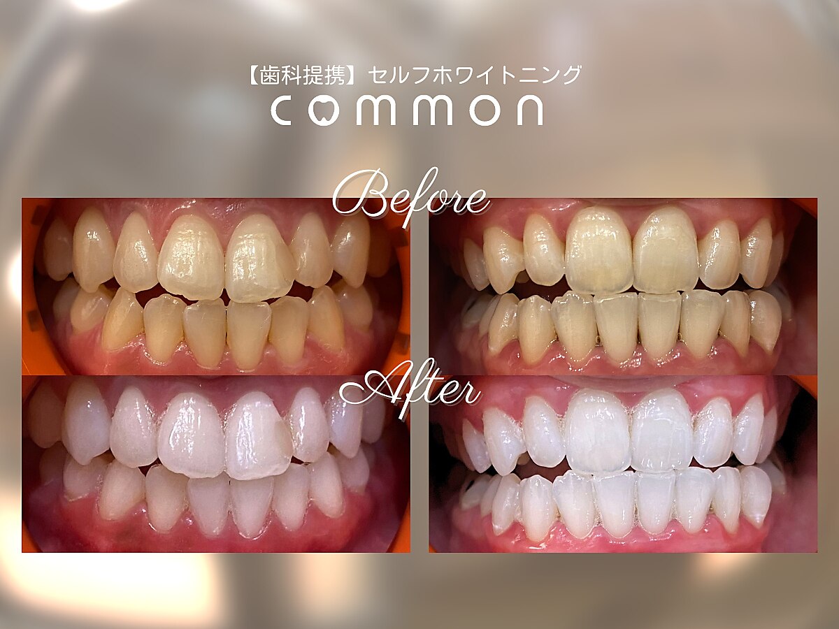 セルフホワイトニングコモン 藤枝店(self whitening common