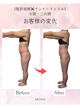 アローナ(ARONA)/加須市の本格的痩身サロン！