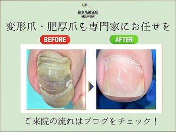 巻き爪補正店 横浜戸塚店の写真/足のお悩みを豊富な経験と技術で改善いたします◎プライべ―ト空間でコンプレックスも相談しやすい♪