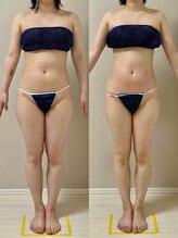 ウム 四ツ橋店(umu)/セルゼロの仕上がり