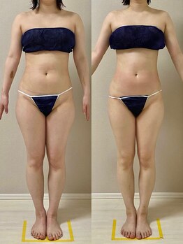 ウム 四ツ橋店(umu)/セルゼロの仕上がり