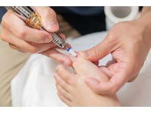 ビオプラス そごう千葉店(bioplus)/巻き爪補正コース