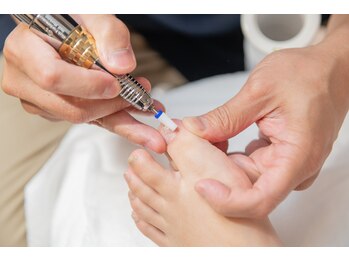 ビオプラス そごう千葉店(bioplus)/巻き爪補正コース